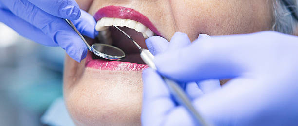 Best Emergency Denture Repair in Winchester, KY